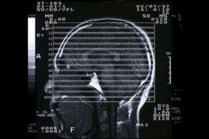 メンタルチェックが義務化される