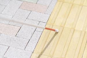 渋谷エリアでインプラント治療を検討している方必見！2025年最新の成功の秘訣と選び方